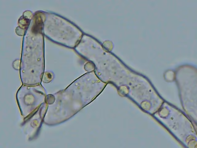 Chromelosporiopsis carnea, photo 3 sur 5