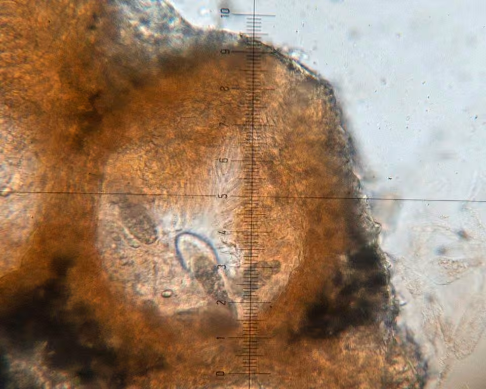 Ovicuculispora parmeliae, photo 3 sur 5