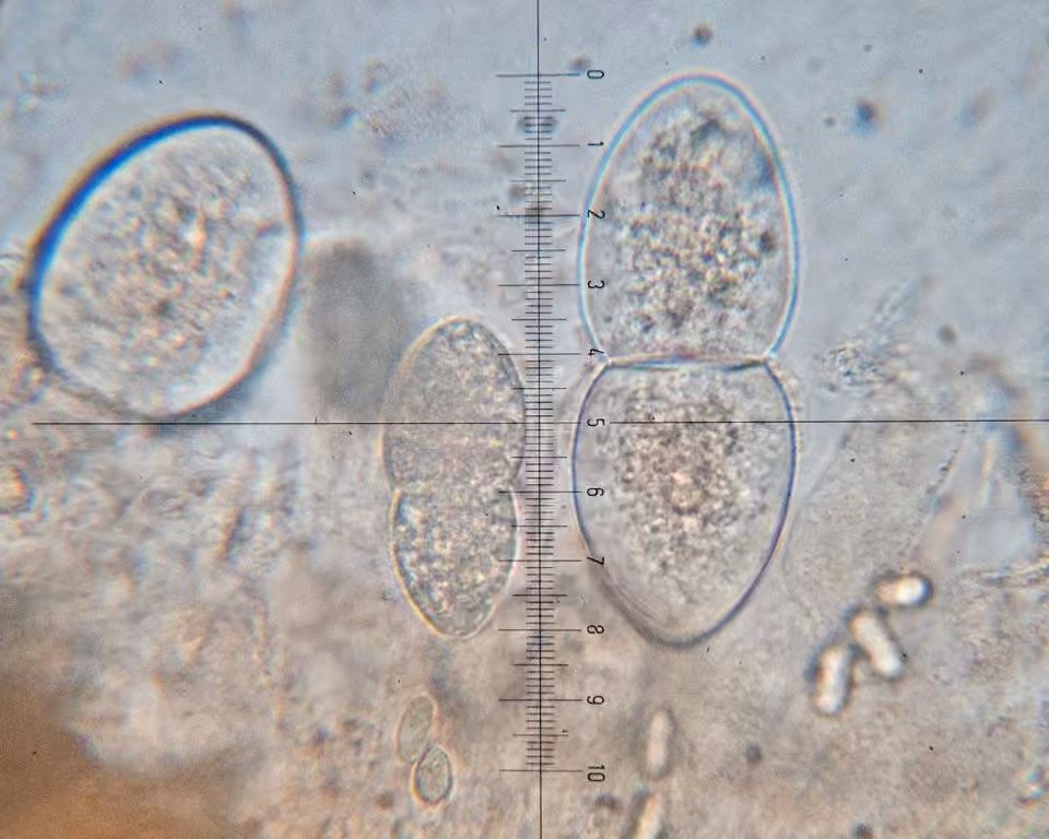Ovicuculispora parmeliae, photo 2 sur 5