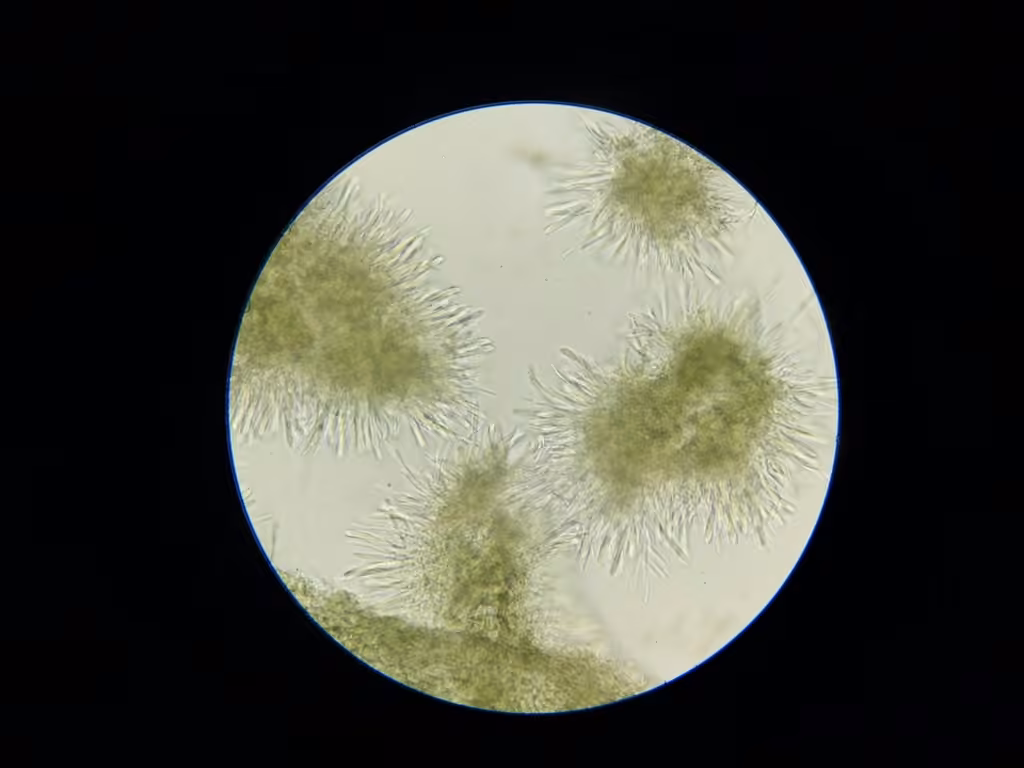 Chlorosplenium chlora, photo 3 sur 5
