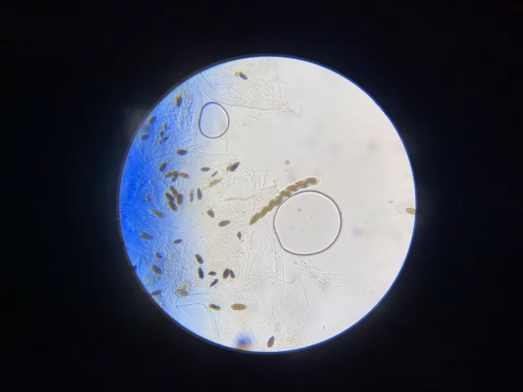 Hysterobrevium mori, photo 3 sur 5