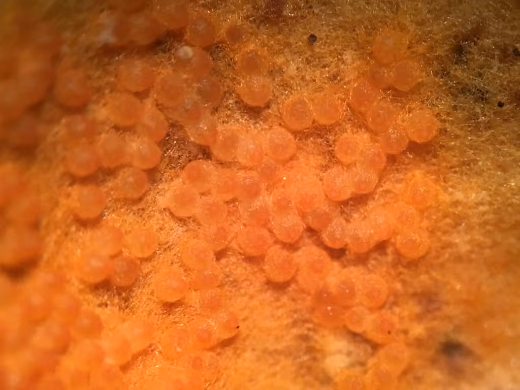 Dermatose orangée, photo 2 sur 5