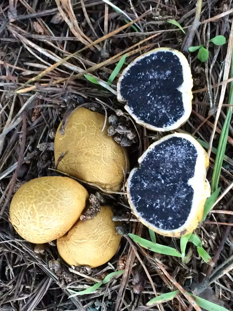 Scléroderme en forme d'oignon