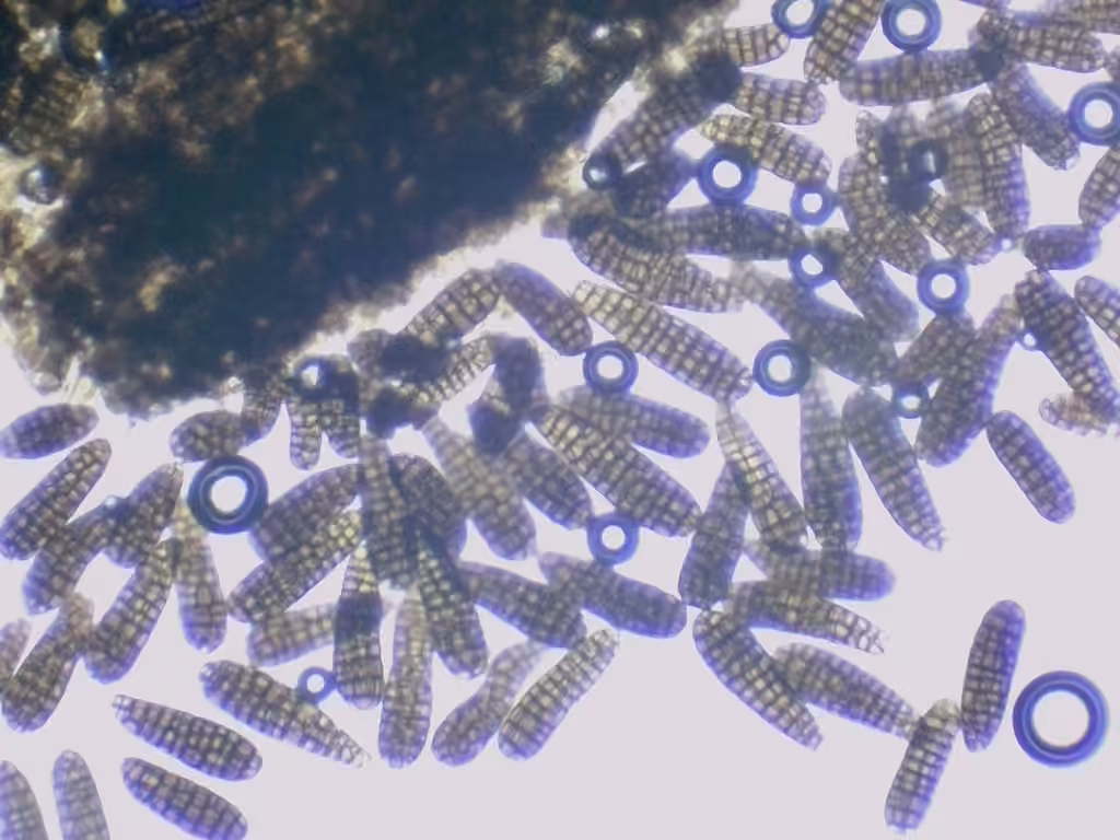 Berkleasmium concinnum, photo 3 sur 5