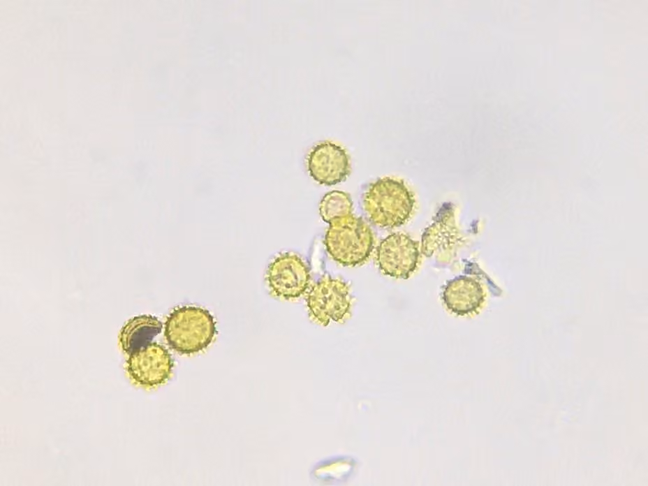 Hypomyces microspermus, photo 2 sur 5